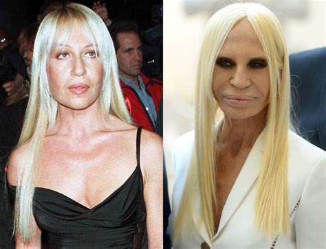 versace plastic surgery|donatella versace without make up.